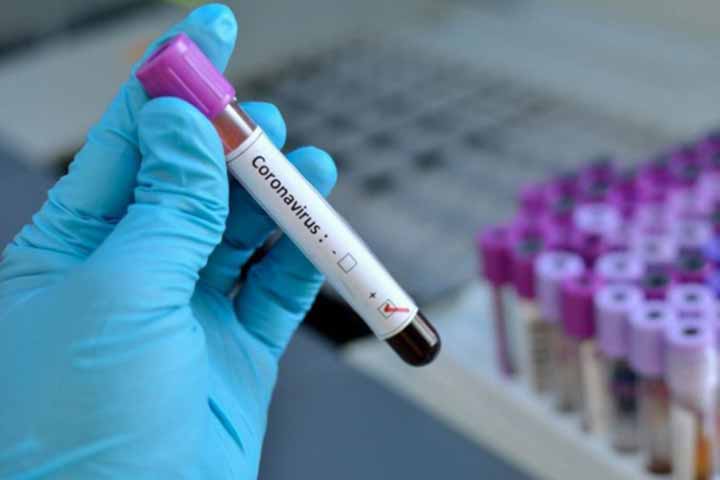 23 MPs tested positive for coronavirus